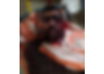 ವಿಟ್ಲ: ಲಾಡ್ಜ್‌ ನಲ್ಲಿ ಗಂಭೀರ ಗಾಯಗೊಂಡ ಸ್ಥಿತಿಯಲ್ಲಿ ವ್ಯಕ್ತಿ ಪತ್ತೆ..!!!