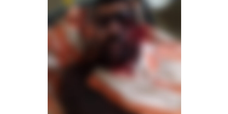 ವಿಟ್ಲ: ಲಾಡ್ಜ್ ನಲ್ಲಿ ಗಂಭೀರ ಗಾಯಗೊಂಡ ಸ್ಥಿತಿಯಲ್ಲಿ ವ್ಯಕ್ತಿ ಪತ್ತೆ..!!!