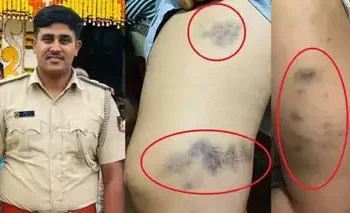 ಪತ್ನಿ ಮೇಲೆ ರಕ್ಕಸ ಕ್ರೌರ್ಯ ಮೆರೆದ ಧರ್ಮಸ್ಥಳ ಠಾಣೆ PSI; ಬೆಲ್ಟ್‌ನಿಂದ ಮನಸೋ ಇಚ್ಛೆ ಹಲ್ಲೆ…!!