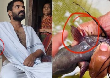 70 ಗ್ರಾಂ ಮೀನು ಬಲಗೈ ನುಂಗಿತು.. ಇನ್ನೂ ಮೈಮರೆತಿದ್ರೆ ದೇಹವನ್ನೇ ನುಂಗಿ ಹಾಕ್ತಿತ್ತು…!!