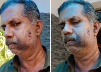 ನಾಲ್ಕನೇ ತರಗತಿಯಲ್ಲಿದ್ದಾಗ ಹೊಡೆದಿದ್ದಕ್ಕೆ 50 ವರ್ಷಗಳ ಬಳಿಕ ಸೇಡು ತೀರಿಸಿಕೊಂಡ ವ್ಯಕ್ತಿ..!!!