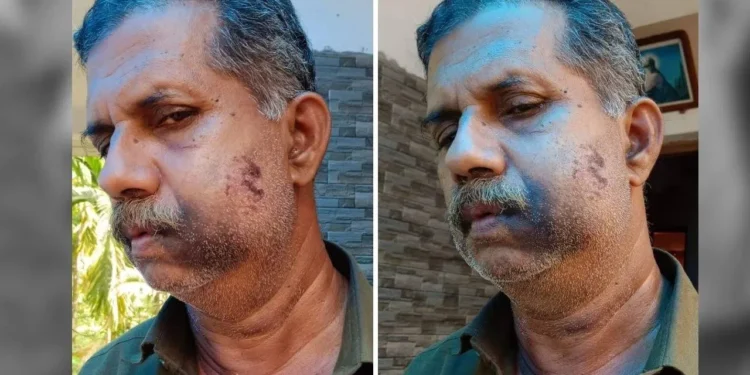 ನಾಲ್ಕನೇ ತರಗತಿಯಲ್ಲಿದ್ದಾಗ ಹೊಡೆದಿದ್ದಕ್ಕೆ 50 ವರ್ಷಗಳ ಬಳಿಕ ಸೇಡು ತೀರಿಸಿಕೊಂಡ ವ್ಯಕ್ತಿ..!!!