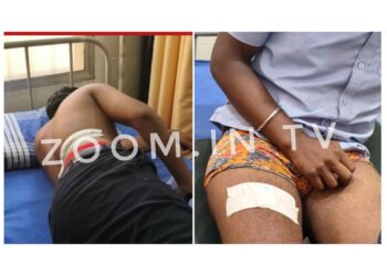 ವಿಟ್ಲ: ಐಟಿಐ ವಿದ್ಯಾರ್ಥಿಗಳ ನಡುವೆ ಜಗಳ :ಚೂರಿ ಇರಿತ..!!