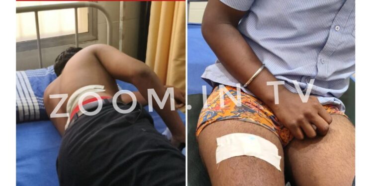 ವಿಟ್ಲ: ಐಟಿಐ ವಿದ್ಯಾರ್ಥಿಗಳ ನಡುವೆ ಜಗಳ :ಚೂರಿ ಇರಿತ..!!