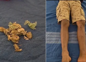 ಬೆಳ್ತಂಗಡಿ : ಆಟವಾಡುತ್ತಿದ್ದ ವೇಳೆ ಸ್ಫೋಟಕ ಸಿಡಿದು ಬಾಲಕನಿಗೆ ಗಾಯ..!