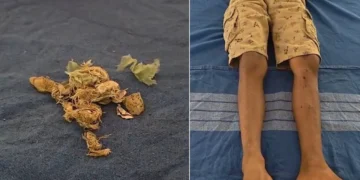 ಬೆಳ್ತಂಗಡಿ : ಆಟವಾಡುತ್ತಿದ್ದ ವೇಳೆ ಸ್ಫೋಟಕ ಸಿಡಿದು ಬಾಲಕನಿಗೆ ಗಾಯ..!