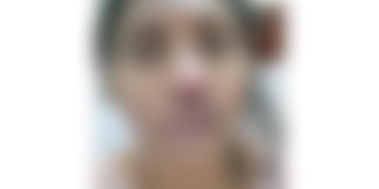 ಮಾವನಿಂದ ಅನುಚಿತ ವರ್ತನೆ, ಹಲ್ಲೆ ಹಾಗೂ ಜೀವ ಬೆದರಿಕೆ: ಪ್ರಕರಣ ದಾಖಲು…!!!