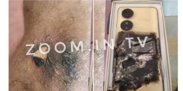 ಮೊಬೈಲ್ ಬ್ಯಾಟರಿ ಸ್ಪೋಟ: ವ್ಯಕ್ತಿಗೆ ಗಾಯ..!!