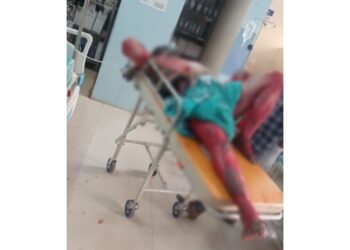 ಬೆಂಕಿ ಹಚ್ಚಿ ಆತ್ಮಹತ್ಯೆಗೆ ಯತ್ನಿಸಿದ್ದ ವ್ಯಕ್ತಿ ಚಿಕಿತ್ಸೆ ಫಲಕಾರಿಯಾಗದೆ ಸಾವು.!!