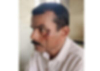 ಸುಳ್ಯ: ಮೆಸ್ಕಾಂ ಕಚೇರಿಯಲ್ಲಿ ಹಲ್ಲೆ ಆರೋಪ; ಪರಸ್ಪರ ರಾಜಿಯಿಂದ ಪ್ರಕರಣ ಇತ್ಯರ್ಥ..!