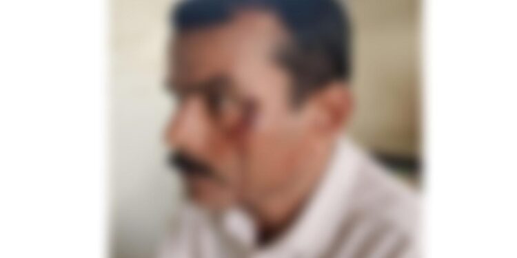 ಸುಳ್ಯ: ಮೆಸ್ಕಾಂ ಕಚೇರಿಯಲ್ಲಿ ಹಲ್ಲೆ ಆರೋಪ; ಪರಸ್ಪರ ರಾಜಿಯಿಂದ ಪ್ರಕರಣ ಇತ್ಯರ್ಥ..!