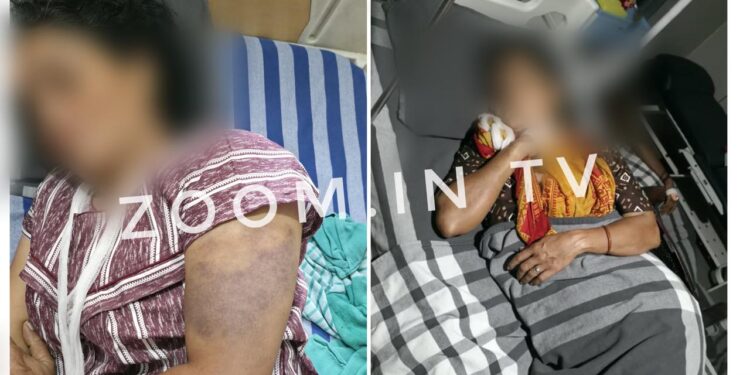 ಹೋಟೆಲ್ಗೆ ನುಗ್ಗಿ ಕುಟುಂಬದ ಮೇಲೆ ಹಲ್ಲೆ : ಮಹಿಳೆಗೆ ಕಿರುಕುಳ : 5 ಮಂದಿ ವಿರುದ್ಧ ಕೇಸ್..!